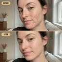 LED Face Mask Lite - Mvolo